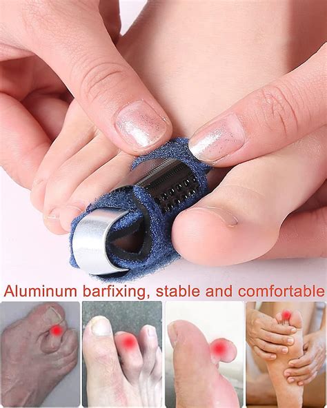 Toe Splint Broken Toe Brace, Toe Straightener For Hammer Toe, Curled
