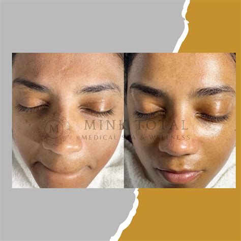 InfluencerGoneWild's Honest Before & After: A Real-Life Transformation Story Image 4