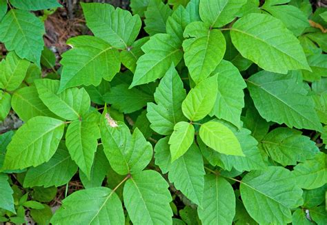 poison ivy relief home remedy 2