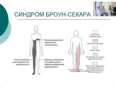 Диагностика объёмных процессов ЦНС - презентация онлайн