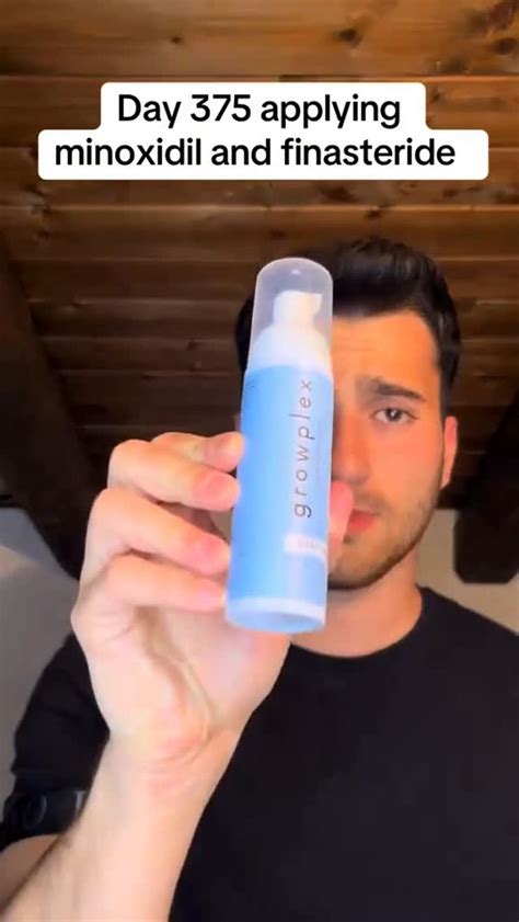 growplex  bleach induced hair loss   full healthy head