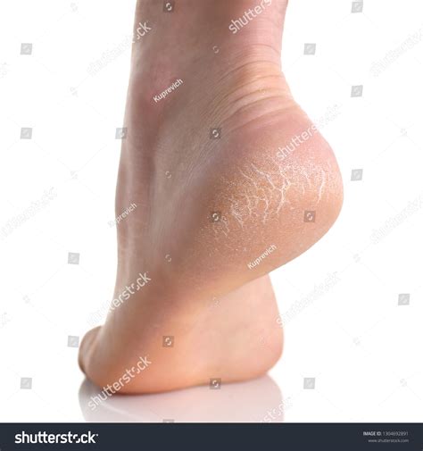 3,541 Cracked Heals Images, Stock Photos & Vectors | Shutterstock