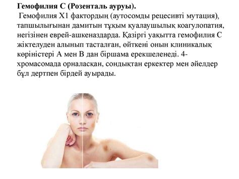 Гемофилия. Гемофилия А этиологиясы және патогенезі - презентация онлайн