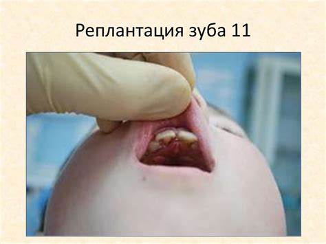 Травма зубов у детей - презентация онлайн
