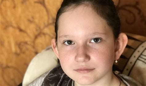 Приходченко Карина: У Карины растет родинка в глазу