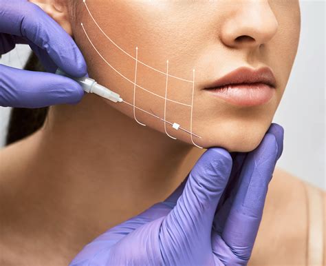 thread lift procedures  abu dhabi aura aesthetics