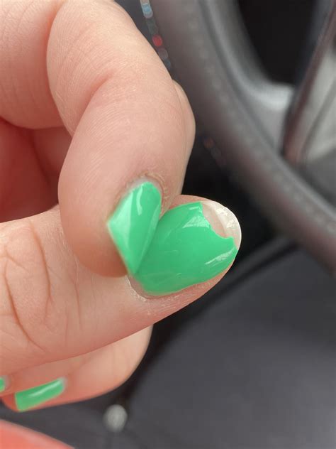 I suffer from an autoimmune disease which causes brittle and weak nails