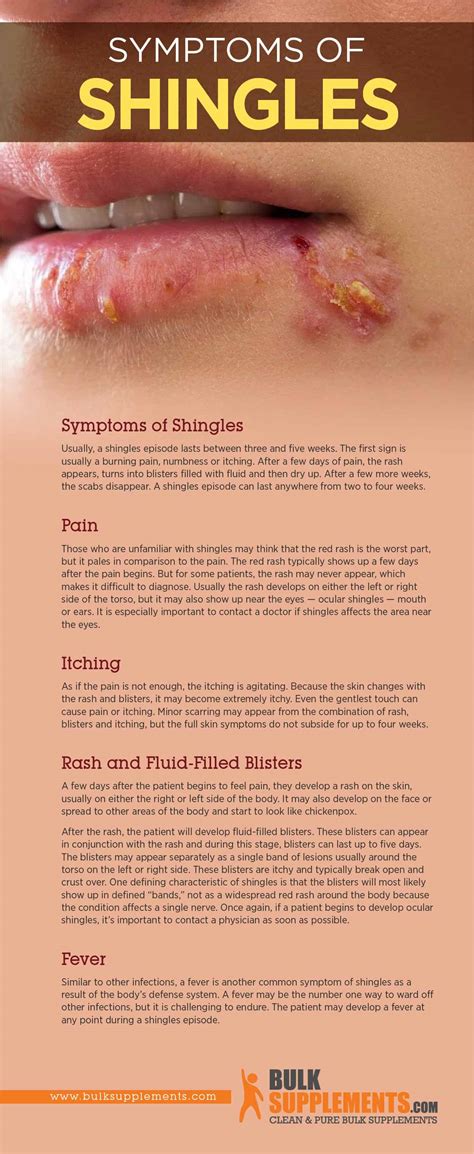 Symptoms Similar To Shingles - Infoupdate.org