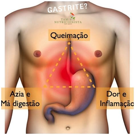 Como É A Dor Da Gastrite