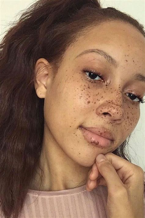 beautiful black women flaunting  freckles essence black