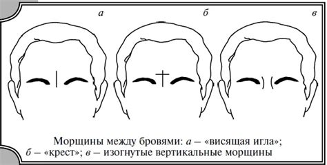 Как убрать морщины между бровями