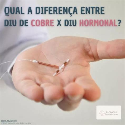Gravidez E Diu De Cobre - Diu Hormonal Como Evitar A Gravidez Usando O DIU Hormonal Gravidez