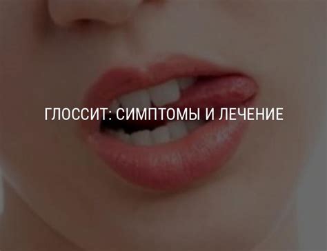 Глоссит: симптомы и лечение у ребенка и взрослого, причины глоссита языка