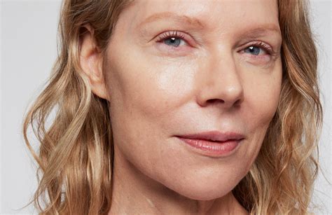 REMEDY for dark spots – Remedy Science by Dr. Muneeb Shah