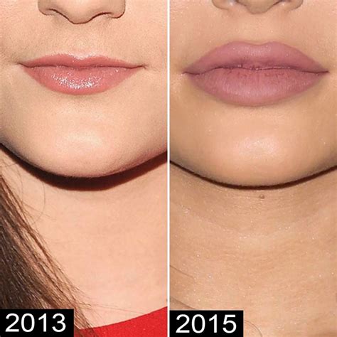 Plastic Surgery? See Kylie Jenner's Body Change Over Time | Life & Style