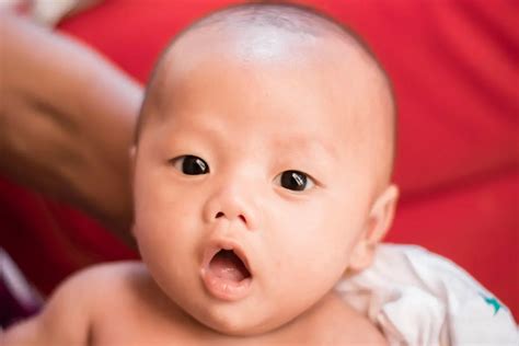 penyebab mata bayi kuning   mengatasinya jec eye hospitals
