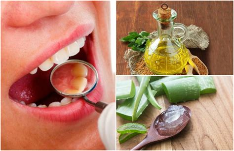 Remedios Caseros Para Apretar Los Dientes Flojos