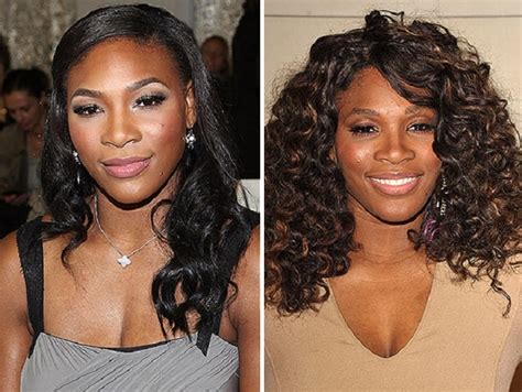 Serena Williams Before and After Plastic Surgery