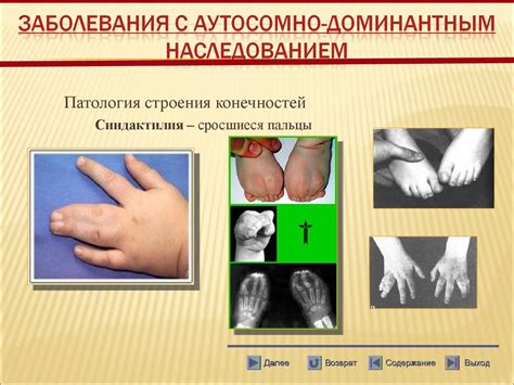 Генетика человека. Генные болезни - презентация онлайн