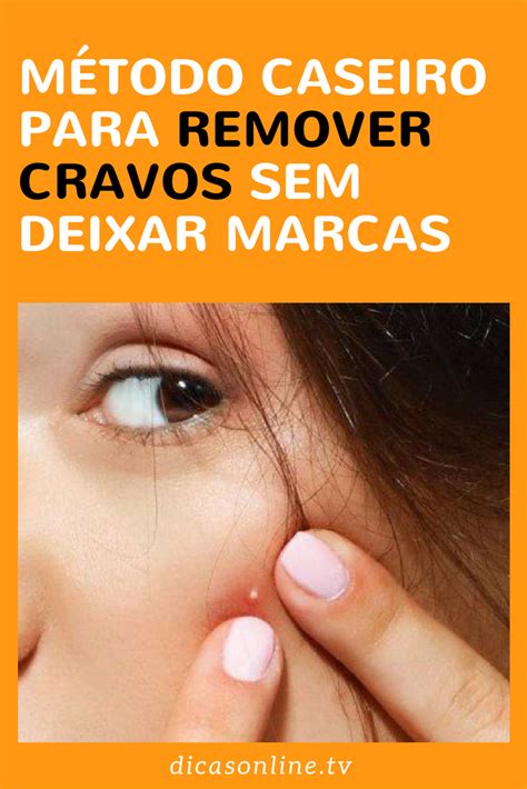 Como Evitar Cravos No Rosto - Como não deixar cicatriz no rosto ao tentar tirar cravos da pele: veja ...