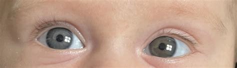 Cor dos olhos (cinza)- 2 meses | BabyCenter