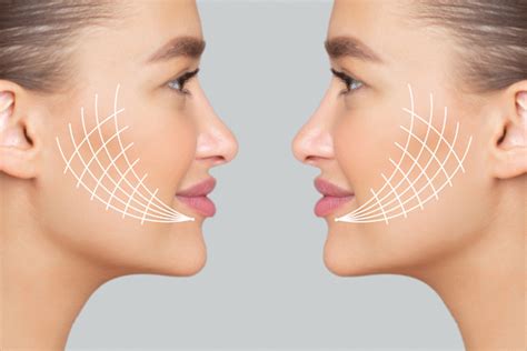 O Que É Harmonizaçao Orofacial - Harmonização Orofacial é reconhecida como legítima especialidade ...