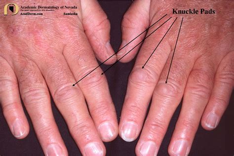 knuckle  definition  marjorie dalton blog