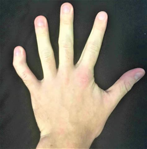 What Doctors WON'T Tell You About Triple X Syndrome: A Celebrity's Journey Image 1