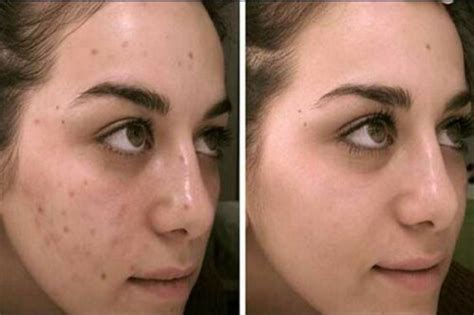 Defacto cream lightening & spot removing cream (1 PACK) – Kismet Beauty ...