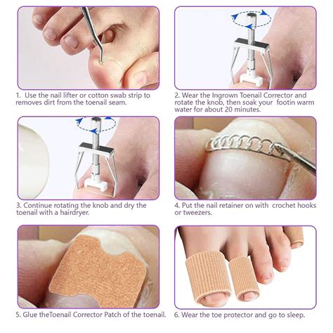 Professional Ingrown Toenail Treatment Kit - Includes Corrector Tool