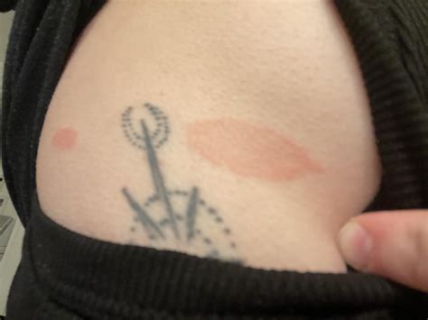 What is this? Started as a small dry skin patch then just got bigger