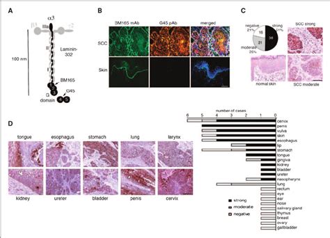 Laminin-332 G45 is present in human SCC tumors but absent in normal... | Download Scientific Diagram