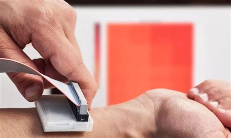 ai powered  invasive device  skin cancer detection receives