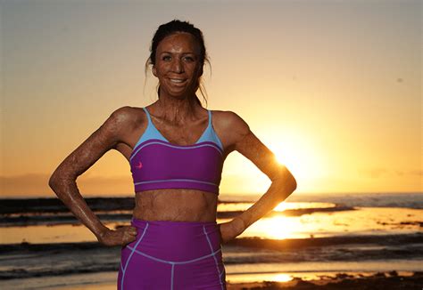 turia pitt  running    gain confidence