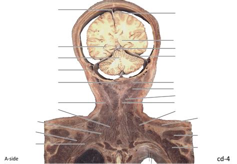 KMU Anatomy Sections