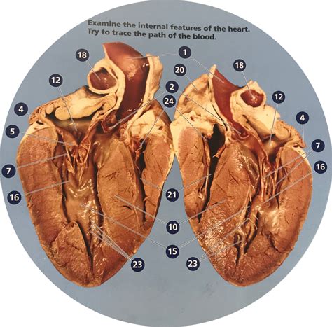 adult pig heart diagram quizlet