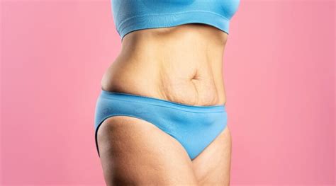 how to fix an apron belly