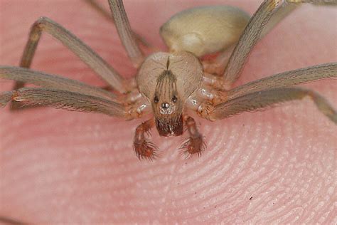 Best Pictures| Artwork: hobo spider bite treatment