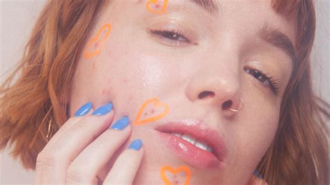 Good Skin vs. Bad Skin: The Cultural Ramifications of ‘Bad Skin’ - Racked