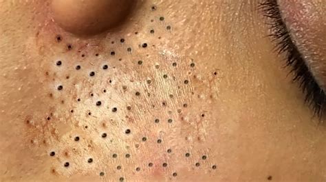 Enjoy Your Day With Hien Nguyen Spa # 1310 - YouTube 