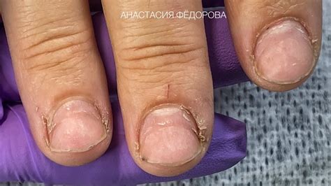 Сложная кутикула, 3 главных правила в наращивание на гелевые типсы🤗 ...