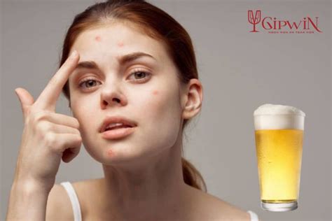 uong bia bi ngua nguyen nhan va giai phap khac phuc