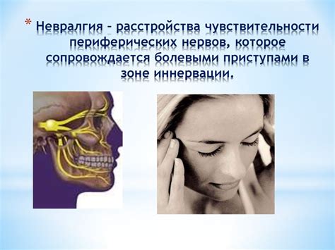 Неврит и невралгия тройничного нерва - презентация онлайн