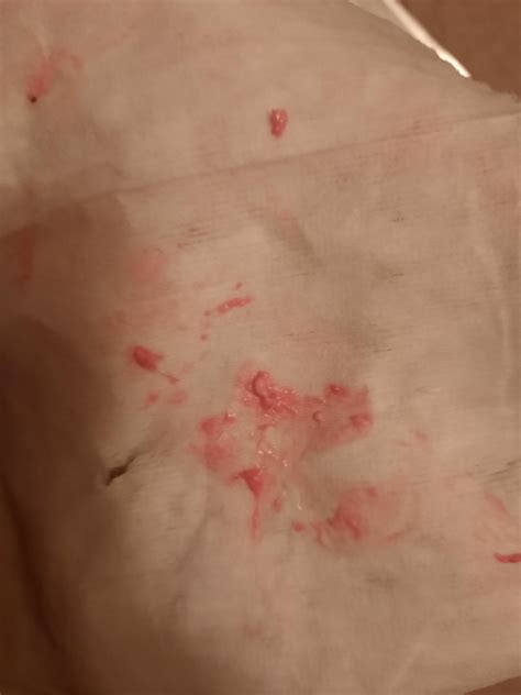 Pink Discharge After Period