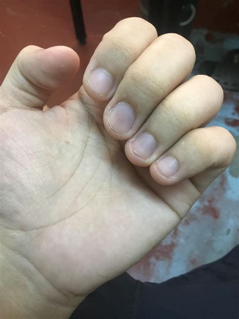 Do i have cyanotic nail beds? : r/AskDocs