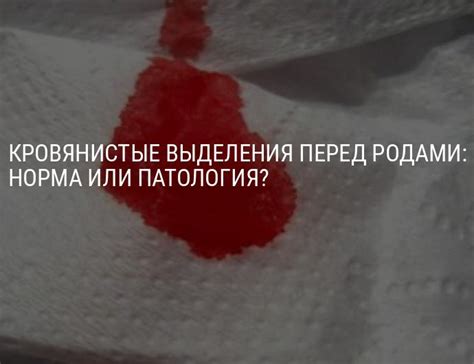 Кровянистые выделения до родов, кровотечение в третьем триместре ...