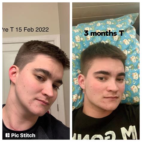 28 yr old FTM: Pre T -> 3 months on T. Not a ton has changed but