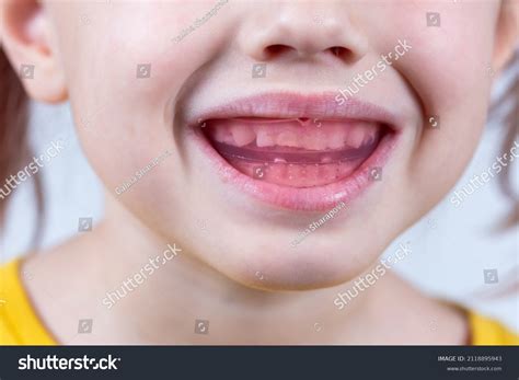 1,071 Baby Biting Tongue Images, Stock Photos & Vectors | Shutterstock