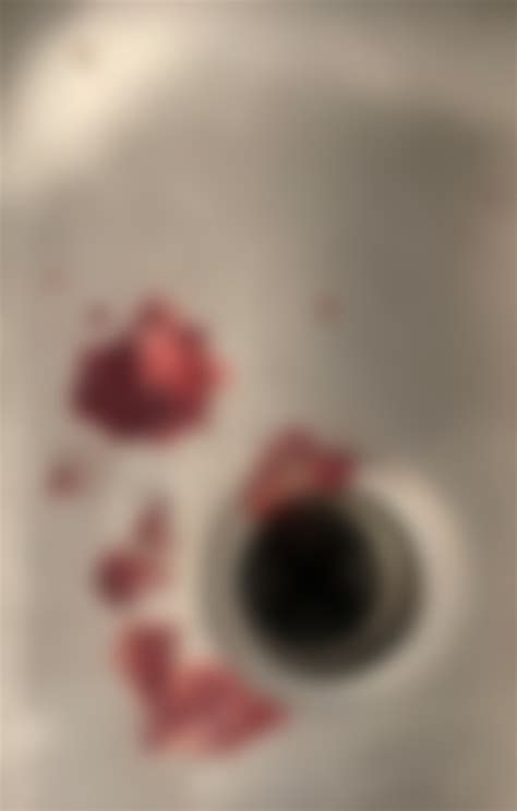 Coughed up a large amount of blood. ER says I’m fine bc bloodwork and chest X ray were normal
