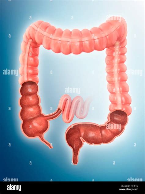 Large intestine, illustration Stock Photo - Alamy